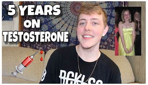 FTM: 5 YEARS ON TESTOSTERONE TIMELINE COMPARISON - YouTube