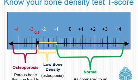 Understanding Bone Density Results - American Bone Hea...
