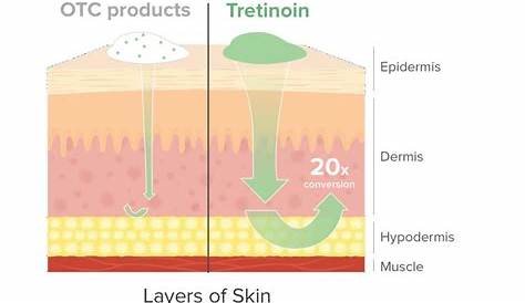 retin a tretinoin strength chart