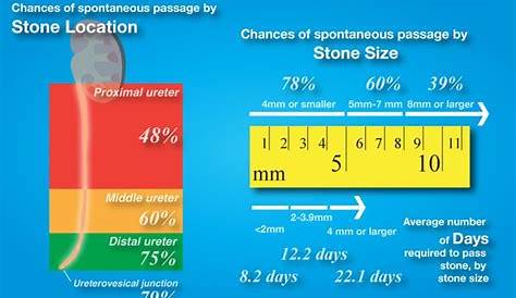 21 best images about Kidney Stones on Pinterest | Uric acid, Canada and