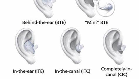 widex hearing aid parts diagram