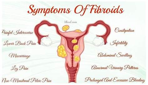 Fibroids Miracle™ Review | Fibroid uterus, Uterine fibroids symptoms