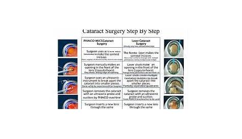 Bildergebnis für eye cataract types | Eye cataract, Cataract, Cataract