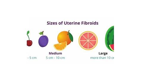 A Visual Guide To Fibroid Sizes | USA Fibroid Centers