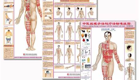 Chinese Cupping(Ba Guan) Therapy Techniques with The Standard Wall Charts (Front/Back/for common