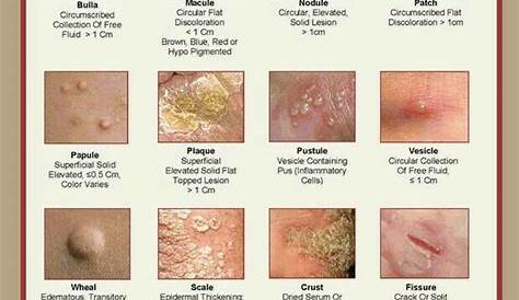 skin lesion flow chart