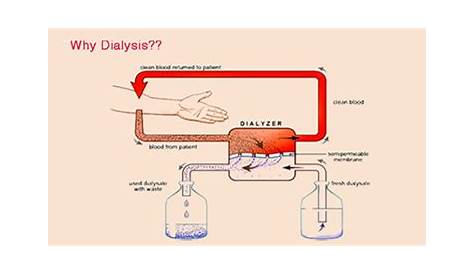 describe the process of dialysis
