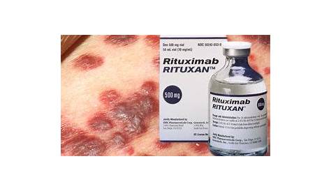 how long is a rituximab infusion