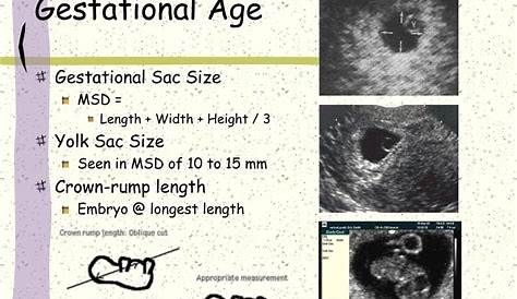 gestational sac size chart