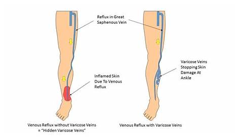 veins lower leg anatomy