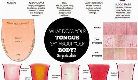 Tongue as an indicator of health - Learning Thursdays