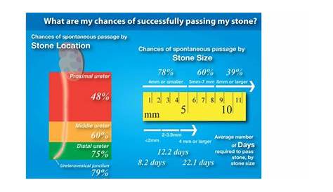 kidney stones size chart