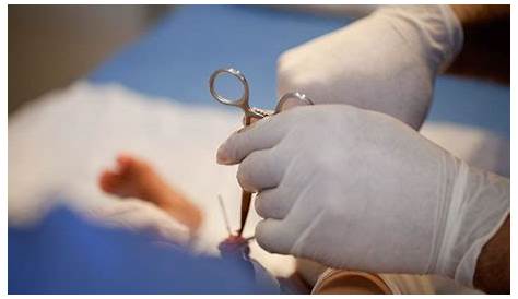 Male circumcision: the unkindest cut of all | Matt Williams | Comment