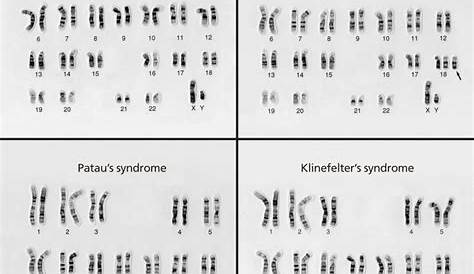 10++ Biology Karyotype Worksheet Answers Pdf – Worksheets Decoomo