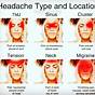 Head Chart For Headaches