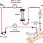 Hemodialysis Machine Circuit Diagram