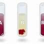 Blood Typing Game Nobel