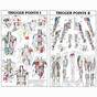 Printable Trigger Points Chart