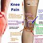 Knee Pain Diagnosis Chart Front