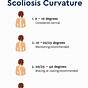 Scoliosis Degrees Of Curvature Chart
