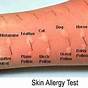 Environmental Allergy Test List
