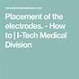 Electrode Placement For Electrical Stimulation Chart