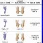 Foot Arch Type Chart
