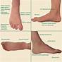 Top Foot Pain Diagnosis Chart