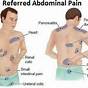 Referred Abdominal Pain Chart
