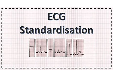 ECG calibration