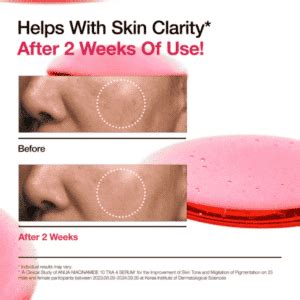 ANUA Niacinamide 10 TXA 4 Serum for Brightening and Dark Spots 30mL ...