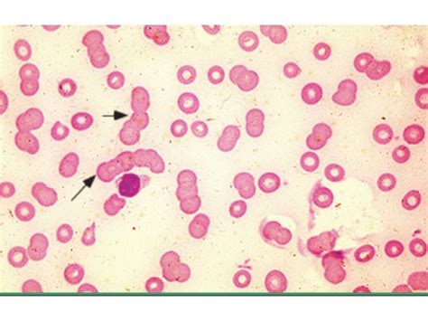 Manifestations of Inflammation Flashcards | Quizlet