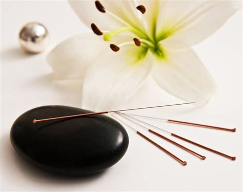 Acupuncture – Healthy Spines Healthy Minds