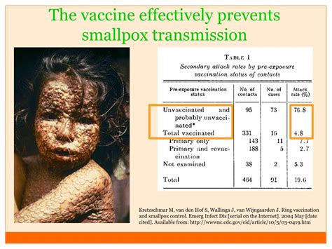 Ppt Smallpox Powerpoint Presentation Free Download Id3061148