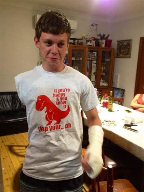 10 Hilarious Amputees Who Lost Their Limbs But Not Their Sense Of