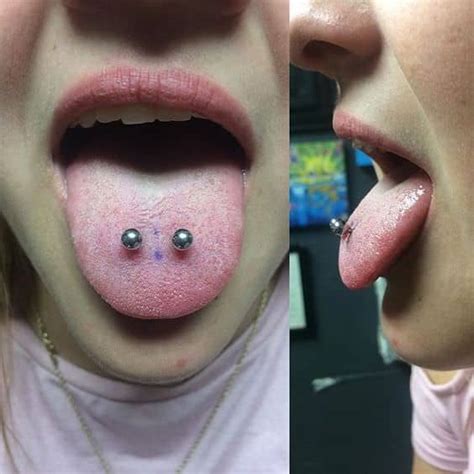 Dental Issues Tongue Piercing Can Cause And How To Avoid Them Oneill