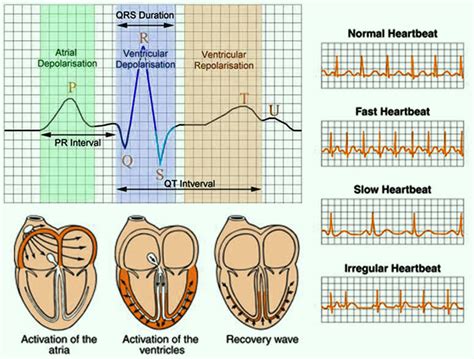 Electrocardiogram Test ECG Procedure Types And Medical Uses