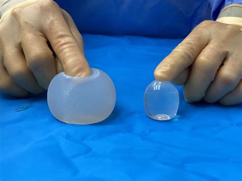 Saline Vs Solid Silicone Testicle Implants Their Seen And Unseen