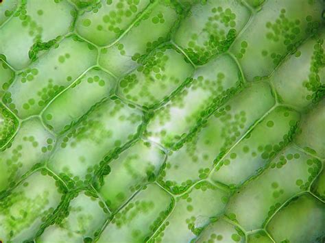 Plant Cell Under Microscope 40x Labeled 1 Chloroplast And Cell Wall