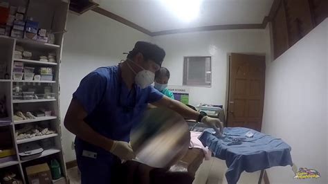 Ashver S Circumcision Filipino Culture Yrs Old YouTube