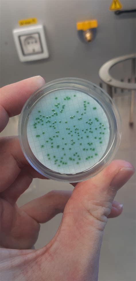 Picture Perfect Pseudomonas Aeruginosa Isolated From A Water Sample