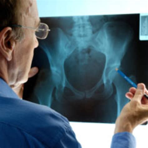 Stryker Trident Ceramic Hip Replacement Lawsuits