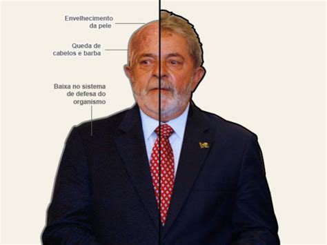 Saiba Como Identificar O Câncer De Laringe A Doença Que Atingiu Lula • Marília Notícia