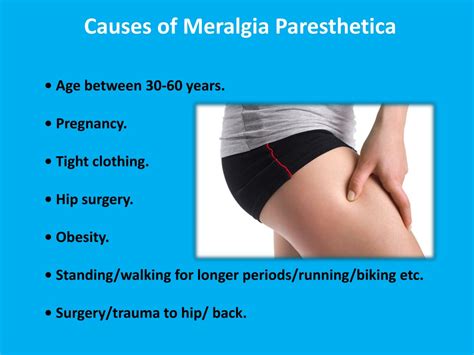 Ppt Meralgia Paresthetica Physiotherapy Pain Free Physiotherapy