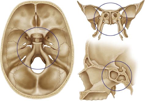 Middle Skull Base Plastic Surgery Key