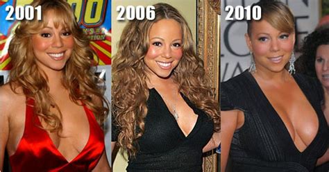 Mariah Carey Plastic Surgery Tummy Tuck Before and After ...