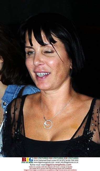 As She Emerges Looking Worse For Wear Again Should Sadie Frost Admit