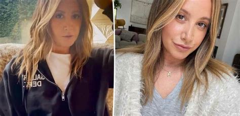 Ashley Tisdale Reveals Alopecia Struggles Connected To Stress Overload I Know All News