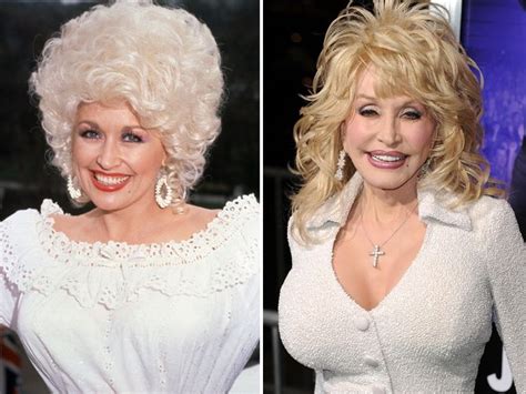 27 best Over the top plastic surgeries images on Pinterest ...