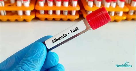 Serum Albumin Test A Test To Check Liver Functions